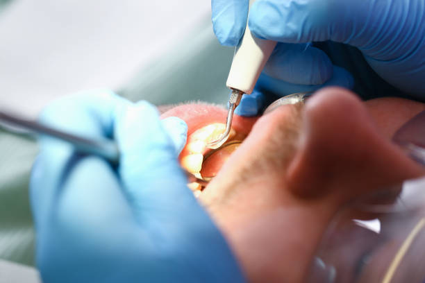 Best Knocked-Out Tooth Emergency  in Cary, IL