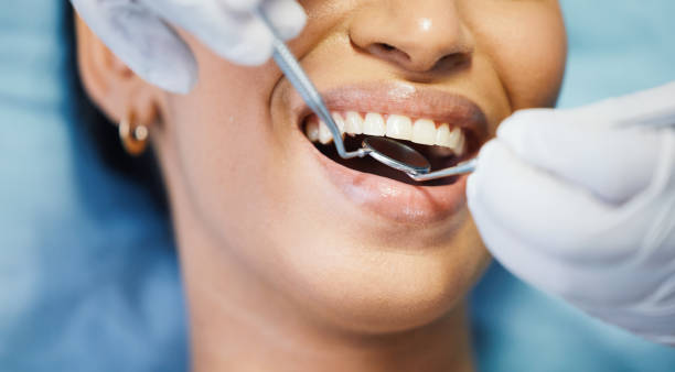 Best Urgent Tooth Repair  in Cary, IL